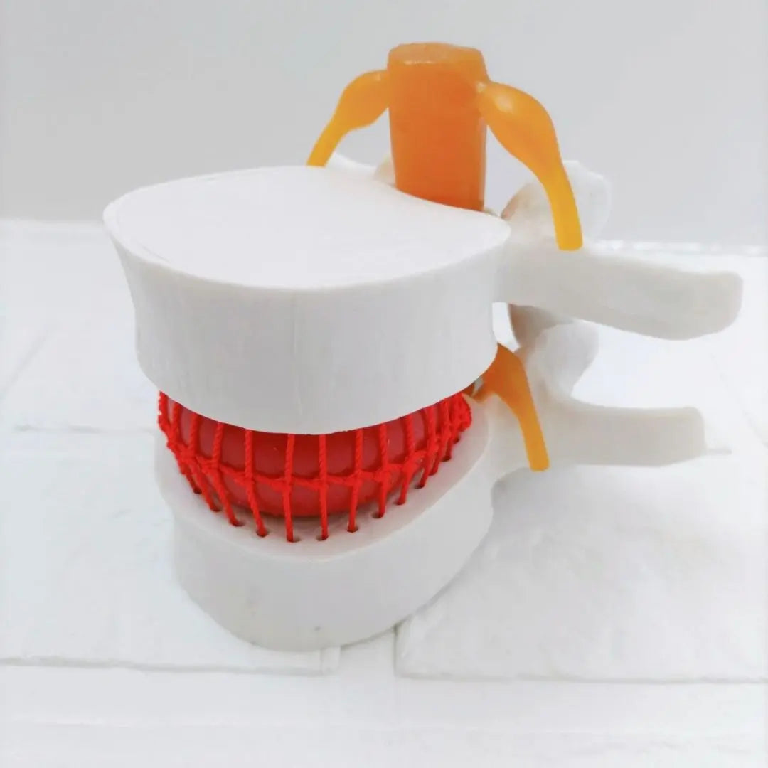 ⭐ Special Price ❗️ Spine model disc herniation model 1: 1.5 Size PVC White