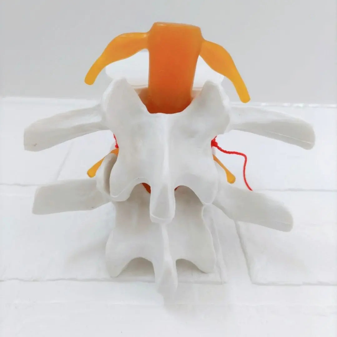 ⭐ Special Price ❗️ Spine model disc herniation model 1: 1.5 Size PVC White