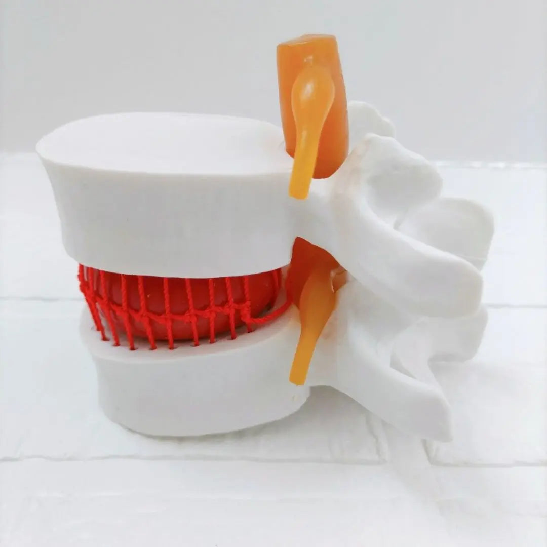 ⭐ Special Price ❗️ Spine model disc herniation model 1: 1.5 Size PVC White