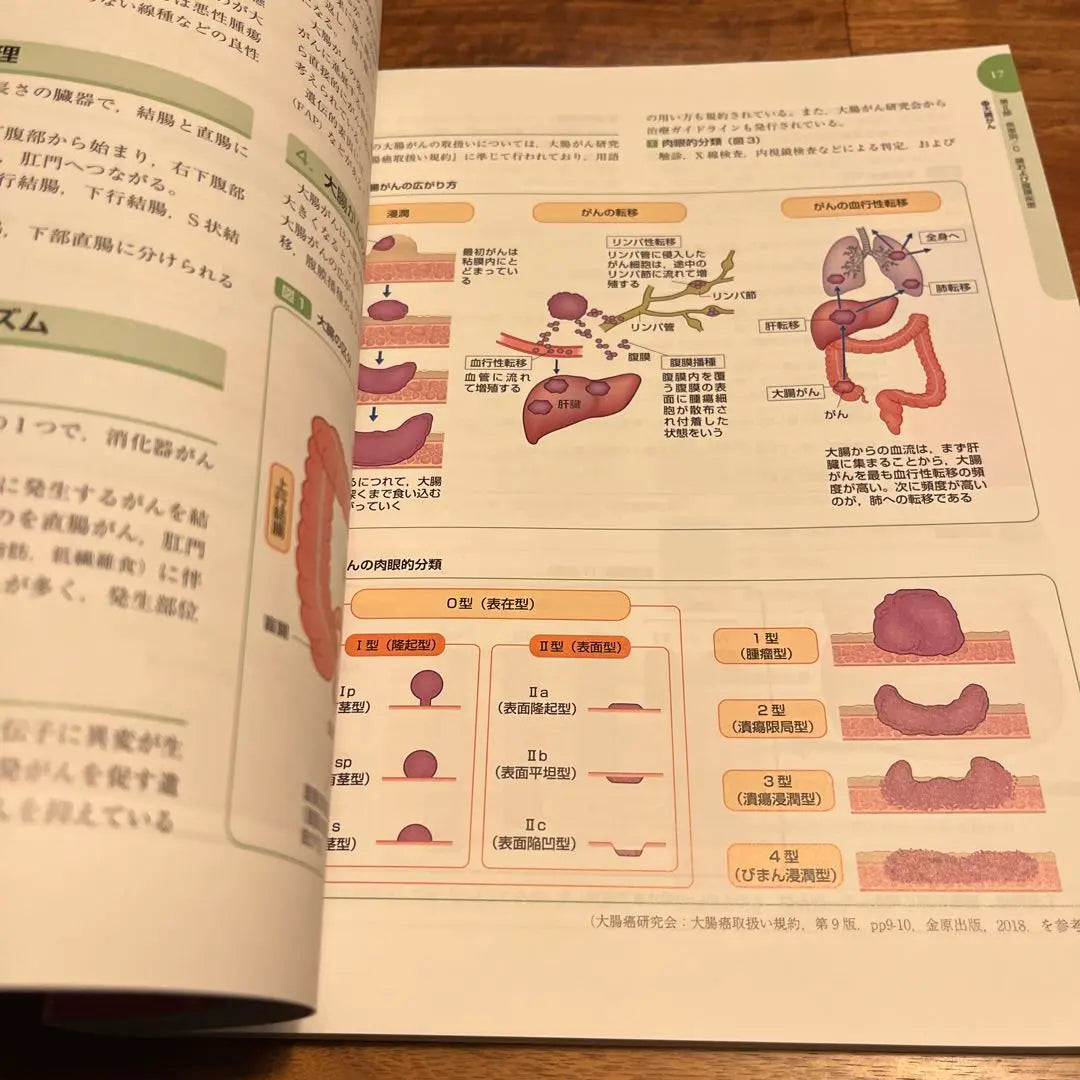 Evidence-based Gastroenterological Nursing Care Related Diagrams