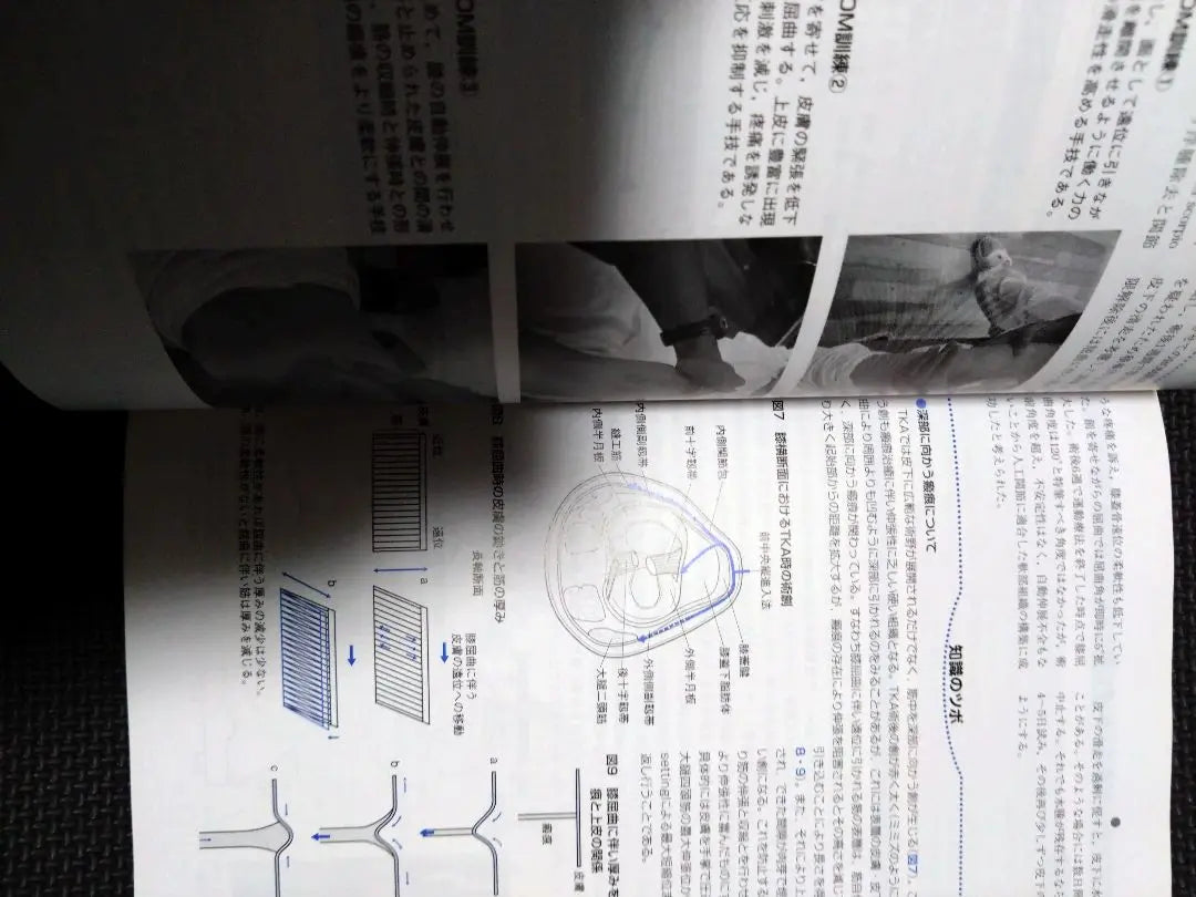 Orthopedic Exercise Therapy Navigation - Based on joint functional anatomy, lower limb trunk, physical therapy, PT