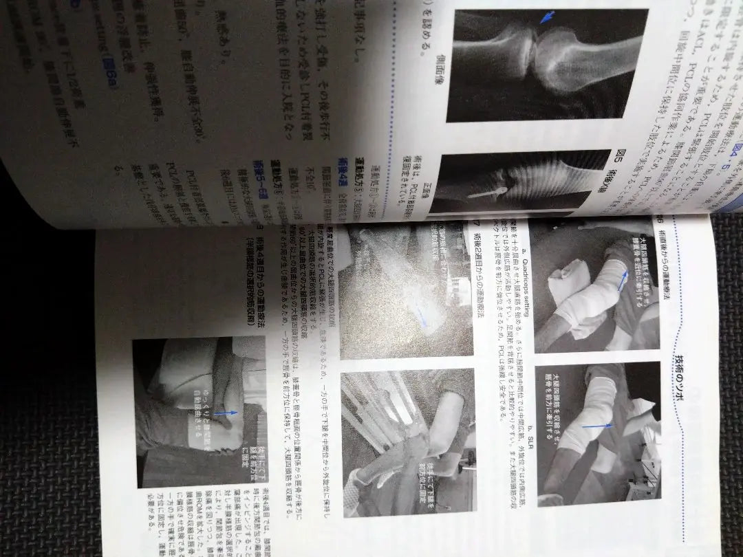 Orthopedic Exercise Therapy Navigation - Based on joint functional anatomy, lower limb trunk, physical therapy, PT